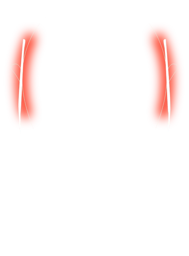 一般的なプラスチックフレーム